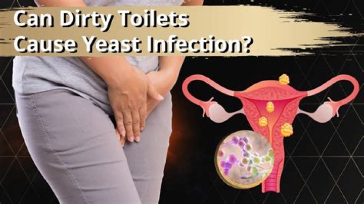 Can Lume Deodorant Trigger Yeast Infections?
